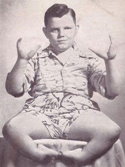 One of the most famous sideshow performers, The Lobster Boy